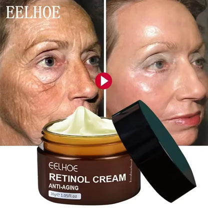 Retinol Wrinkle Remover Face Cream